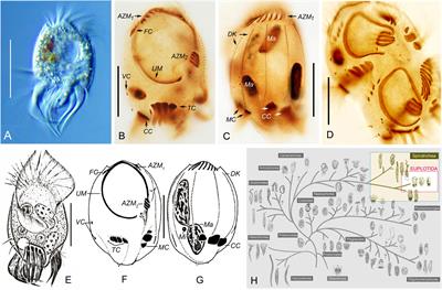 Ultrastructural Features of an Abundant and Ubiquitous Marine Ciliate, Uronychia binucleata (Protista, Ciliophora, Euplotida)